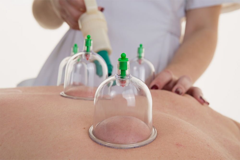 Holistic Hijama