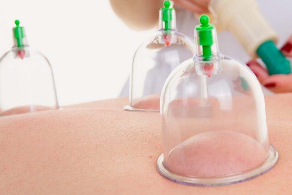 Preventive Hijama