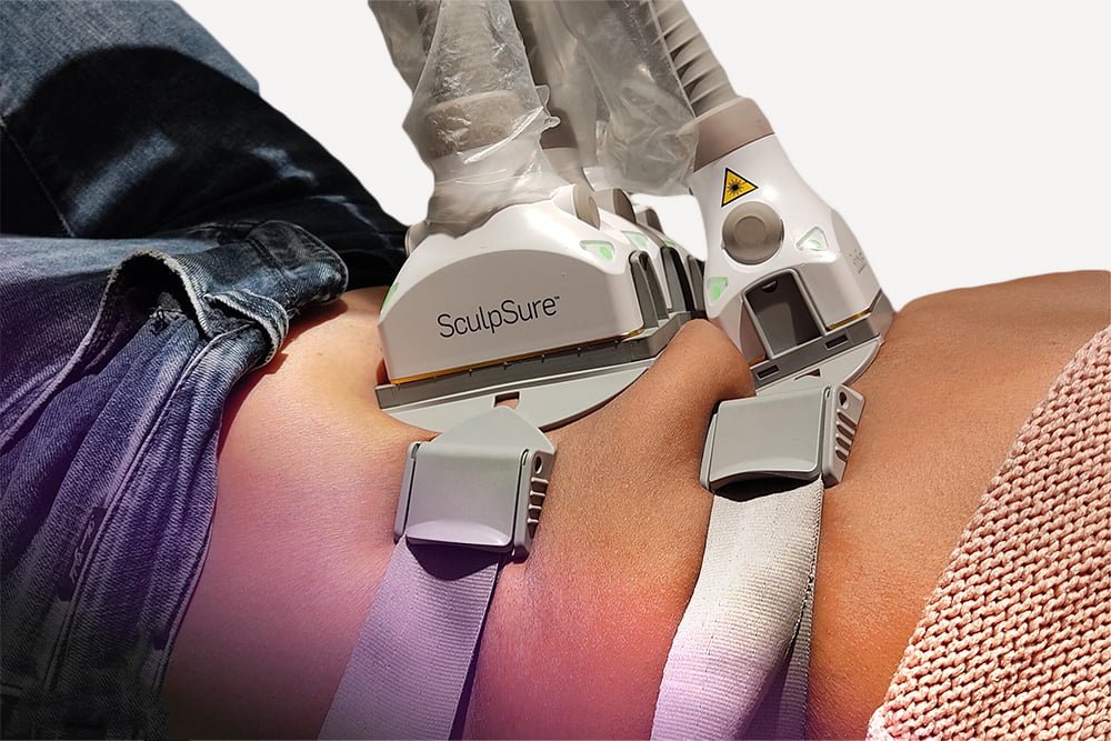 SculpSure Machine