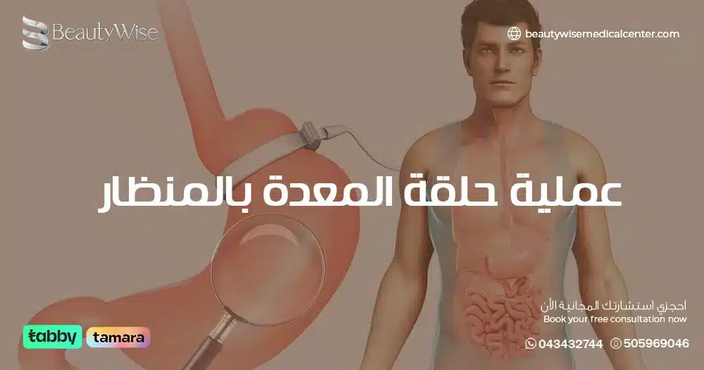 عملية حلقة المعدة بالمنظار