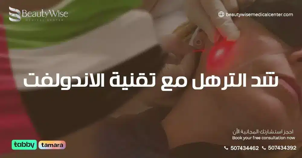 شد الترهل مع تقنية الاندولفت