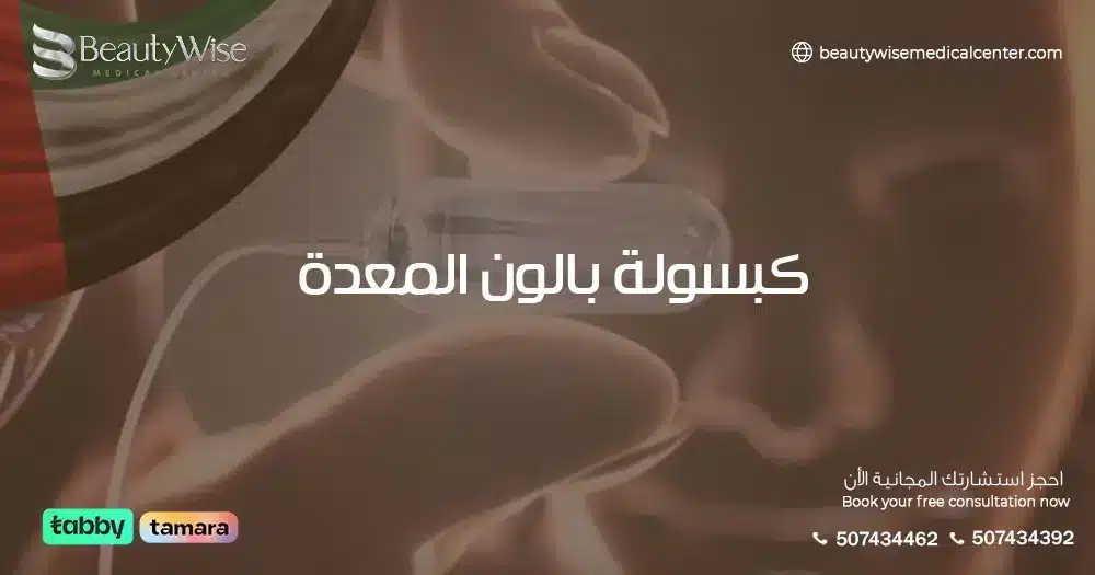 كبسولة بالون المعدة