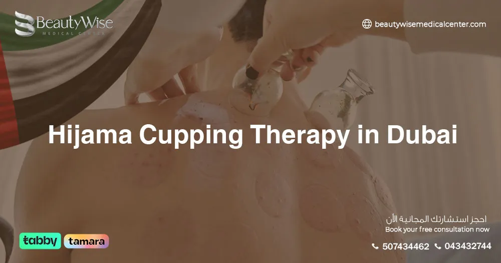 Hijama Cupping Therapy in Dubai