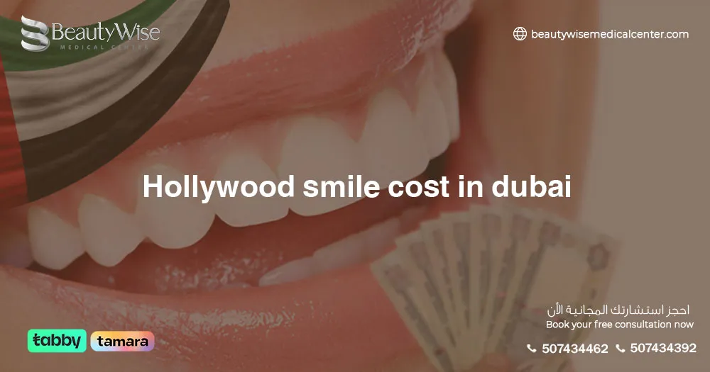 Hollywood Smile Cost in Dubai