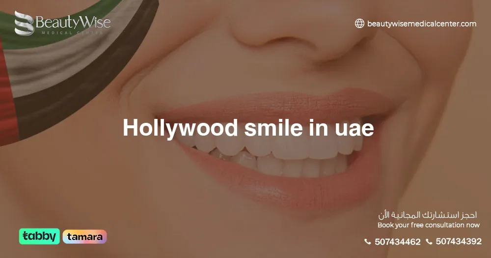 Hollywood Smile in UAE