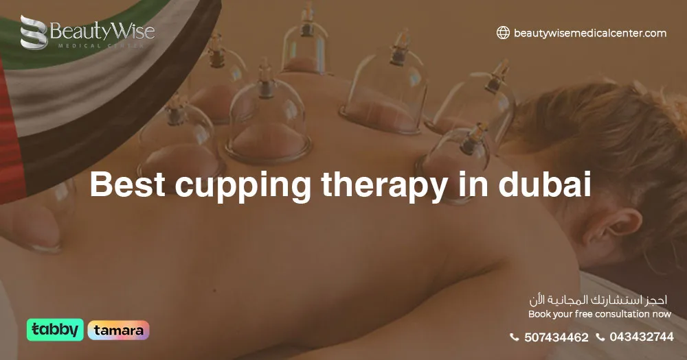 cupping therapy in Dubai