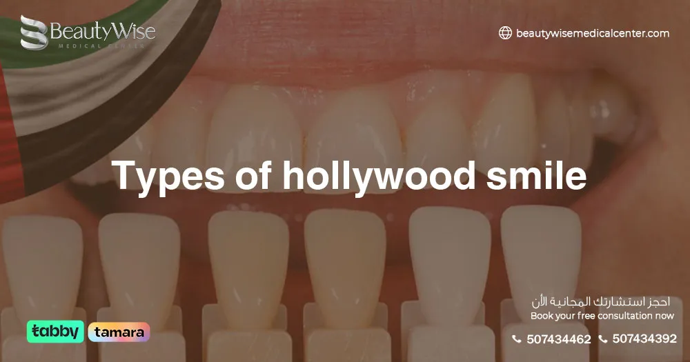 types of Hollywood smile