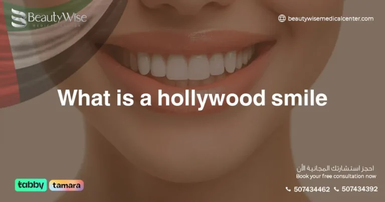 What is a Hollywood smile