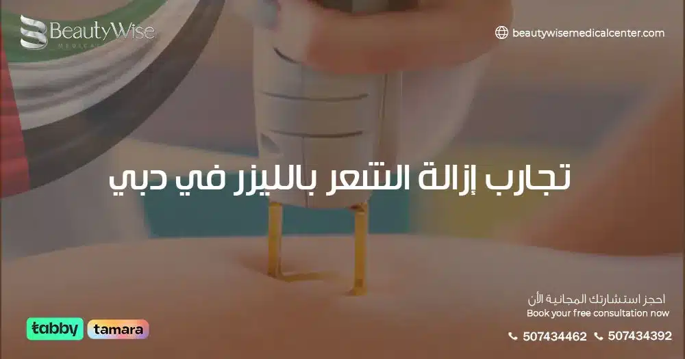 تجارب إزالة الشعر بالليزر في دبي