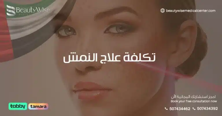 تكلفة علاج النمش