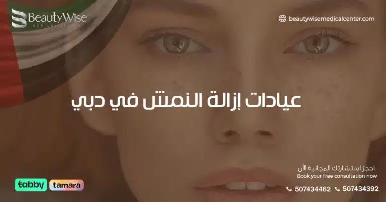 عيادات إزالة النمش في دبي