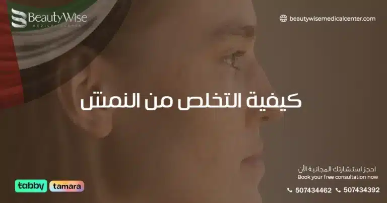 كيفية التخلص من النمش