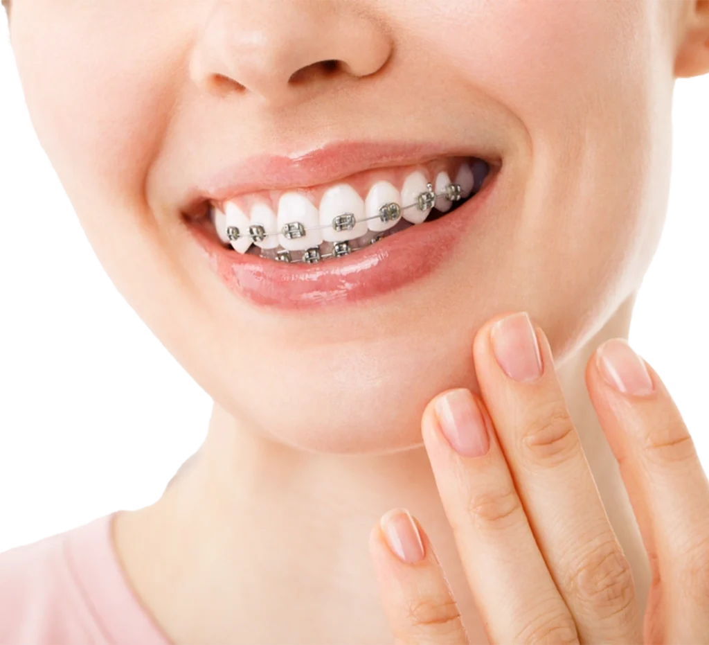 أفضل دكتور تقويم أسنان في دبي