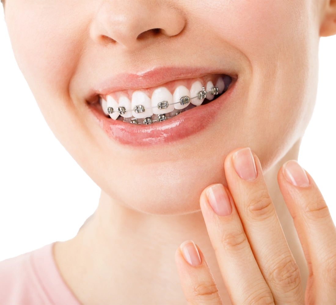 أفضل دكتور تقويم أسنان في دبي