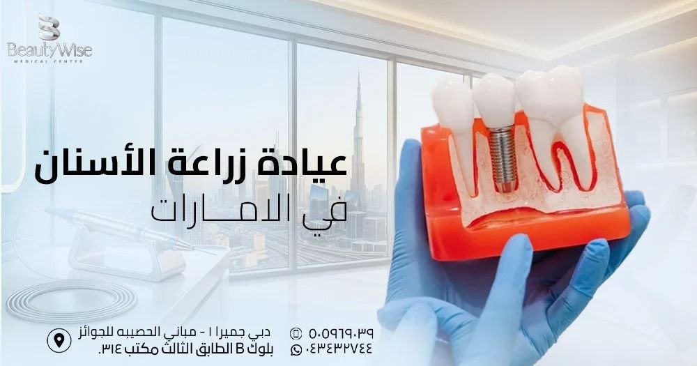 عيادة زراعة الأسنان في الامارات
