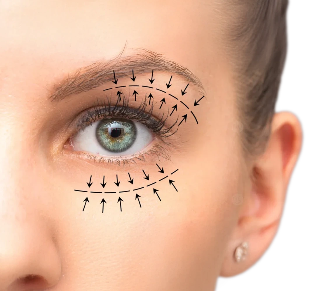 عملية شد الأجفان العلوية والسفلية في الامارات