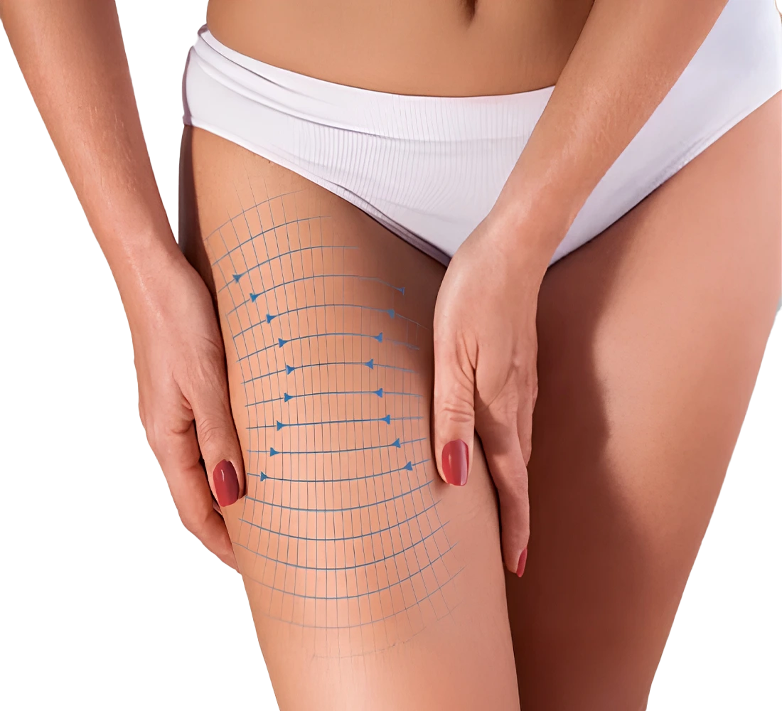 عملية شفط الأفخاذ في الامارات