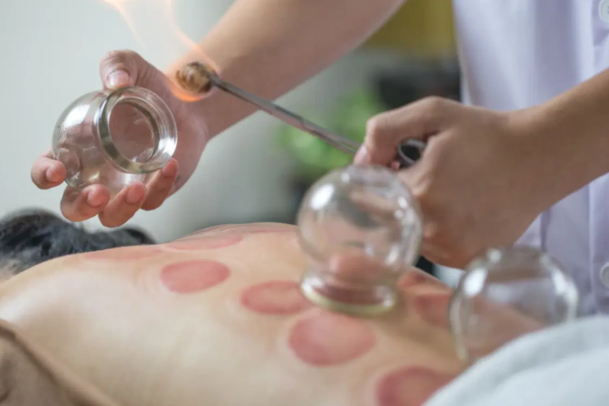 أخصائي الحجامة الشاملة في الامارات