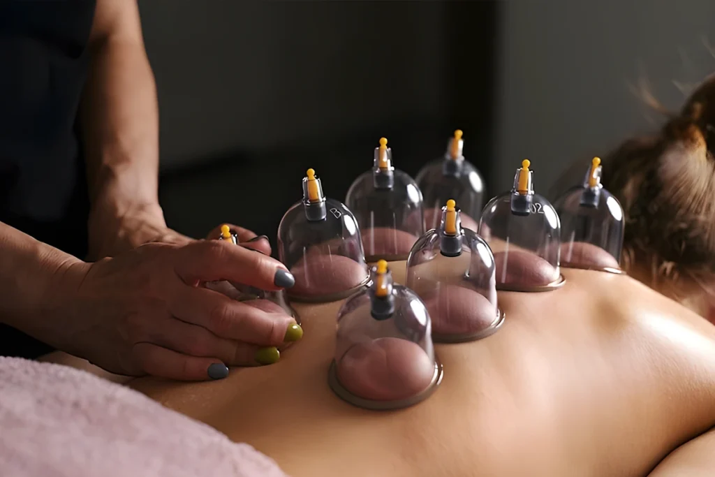 أسعار الحجامة في دبي