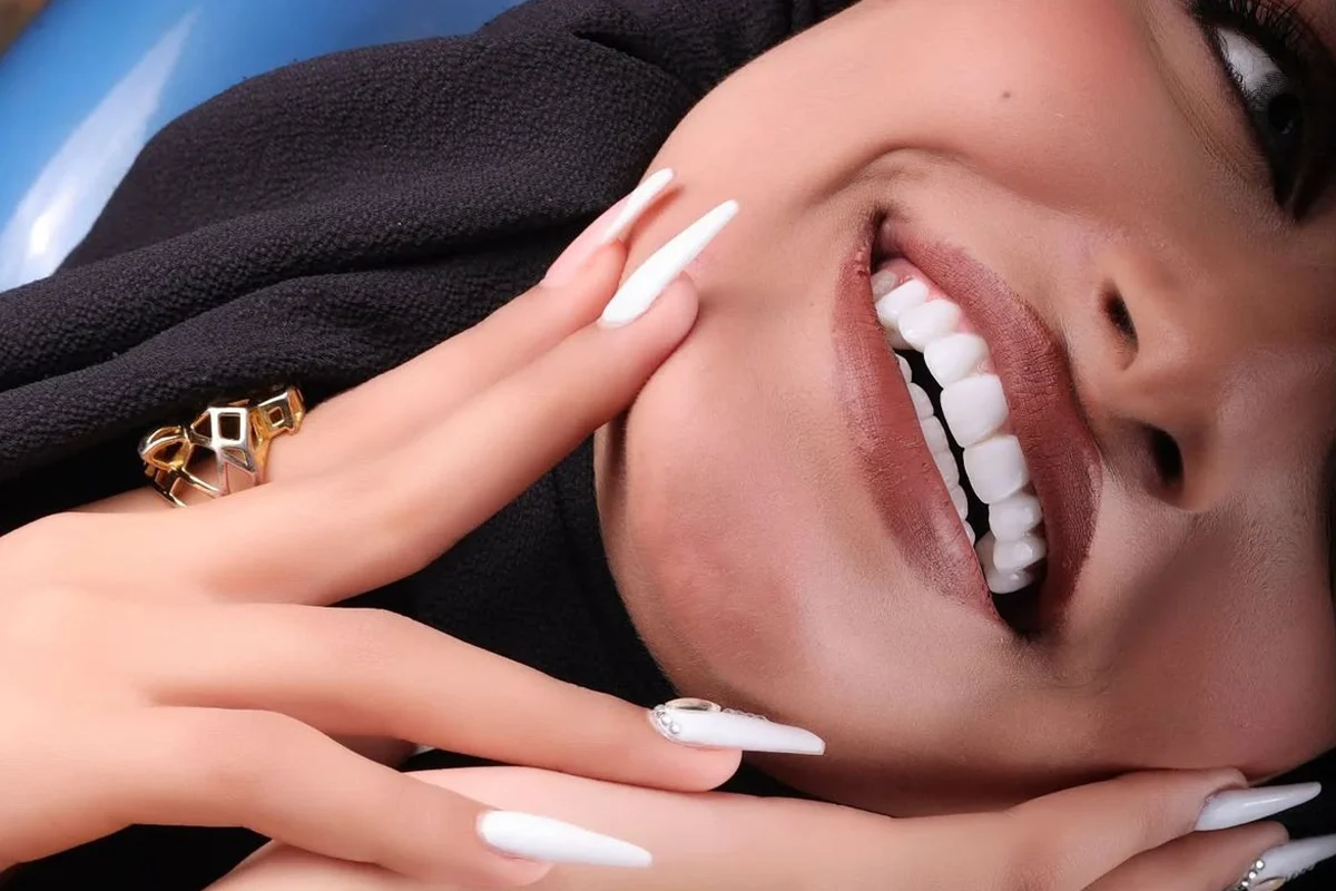 اسعار هوليود سمايل والعوامل المؤثرة