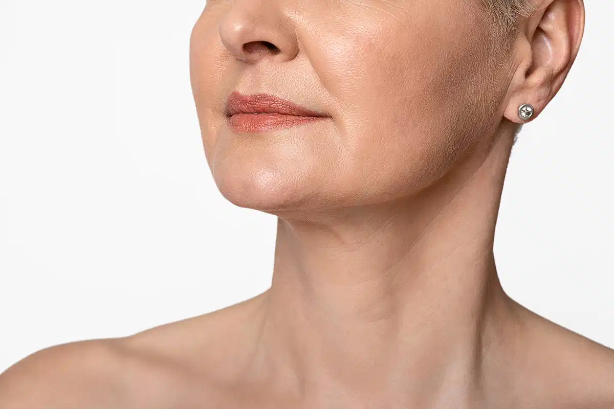 تقنية البيلا تكنيك في الامارات