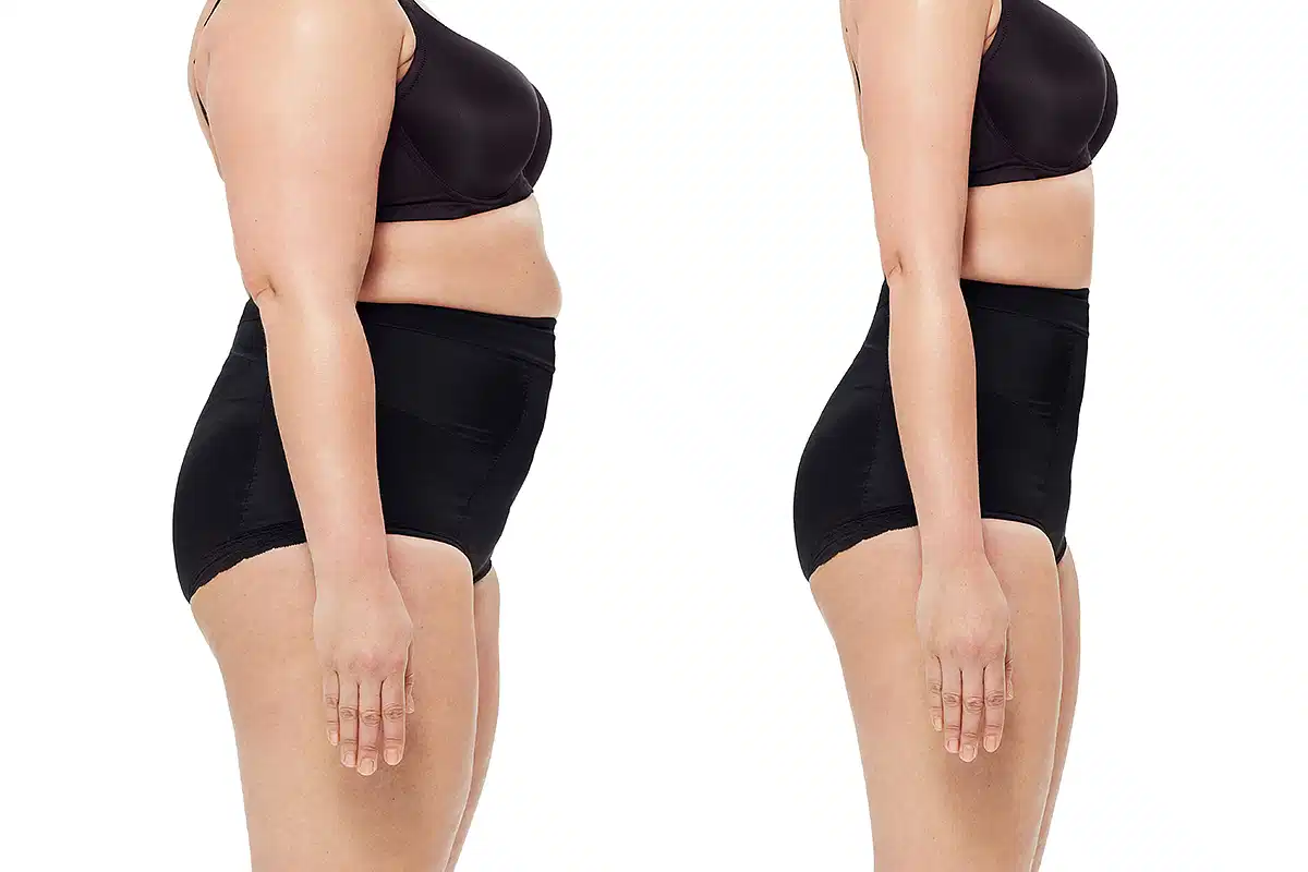 عيادة فقدان الوزن بجراحة