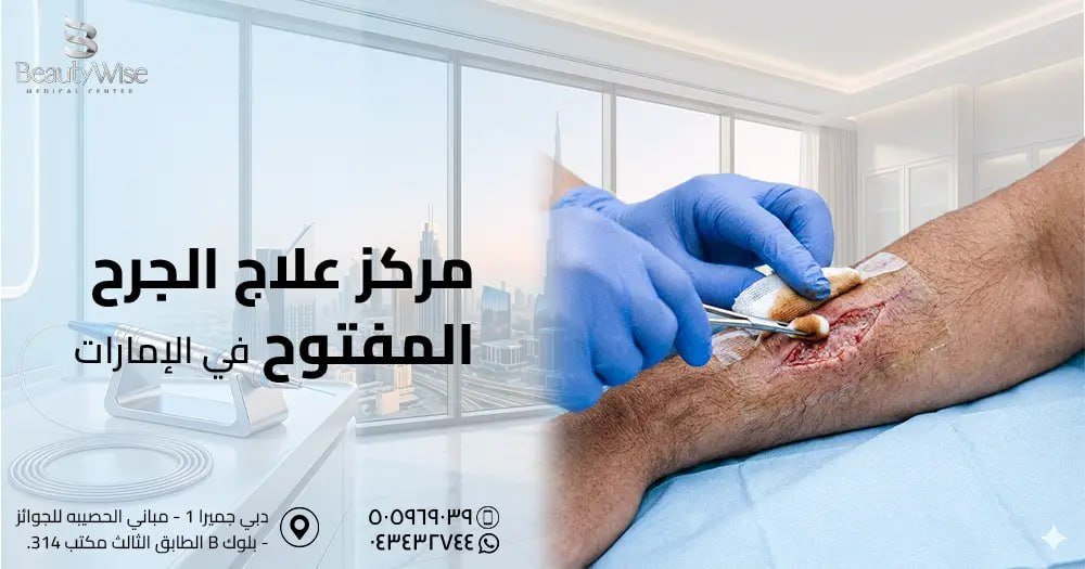 مركز علاج الجرح المفتوح في الامارات