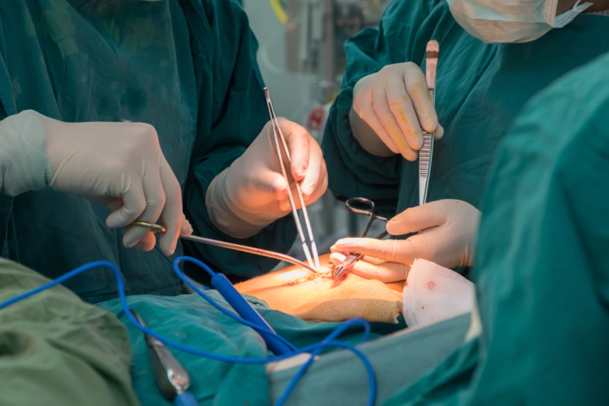 الفرق بين تحويل المسار المصغر والكلاسيكي