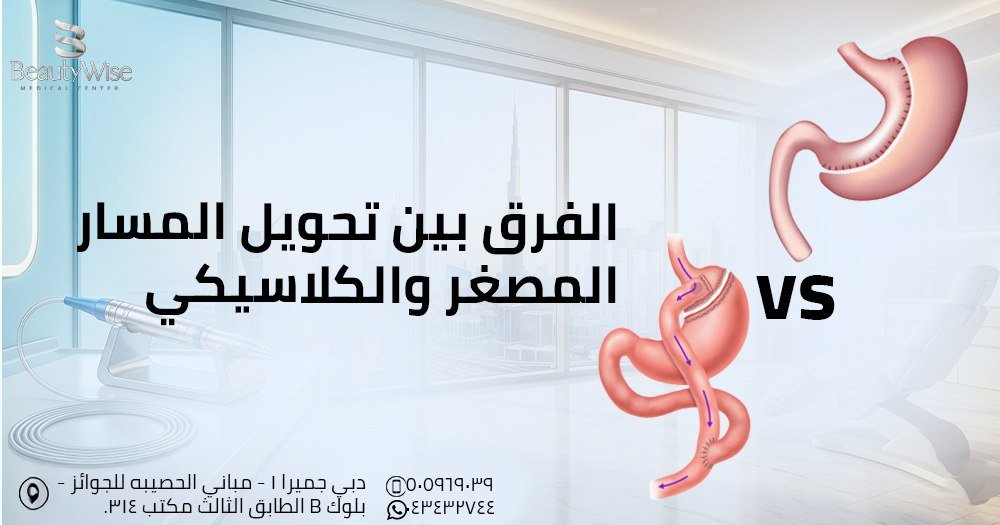 الفرق بين تحويل المسار المصغر والكلاسيكي
