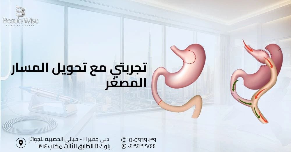 تجربتي مع تحويل المسار المصغر