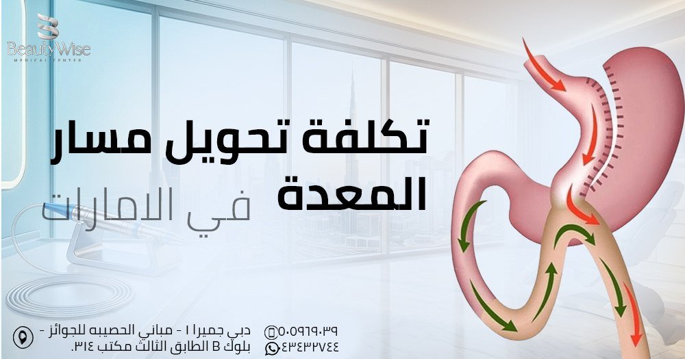 تكلفة تحويل مسار المعدة في الامارات
