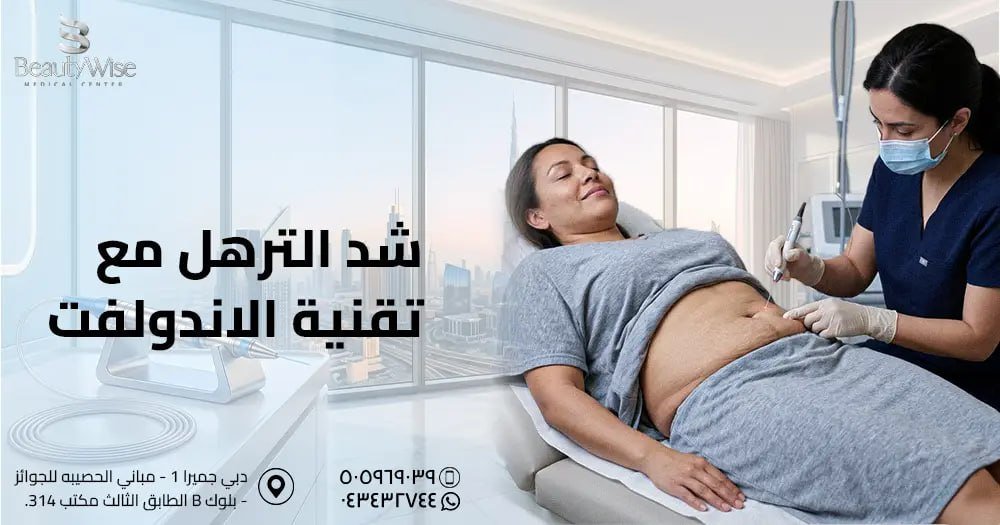 شد الترهل مع تقنية الاندولفت
