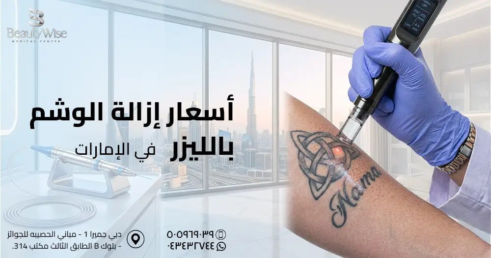 أسعار إزالة الوشم بالليزر في الإمارات