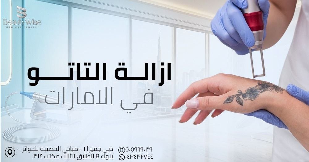 عيادة ازالة التاتو في الامارات
