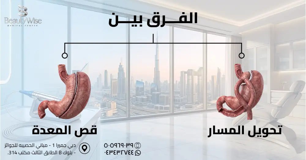 الفرق بين قص المعدة وتحويل المسار