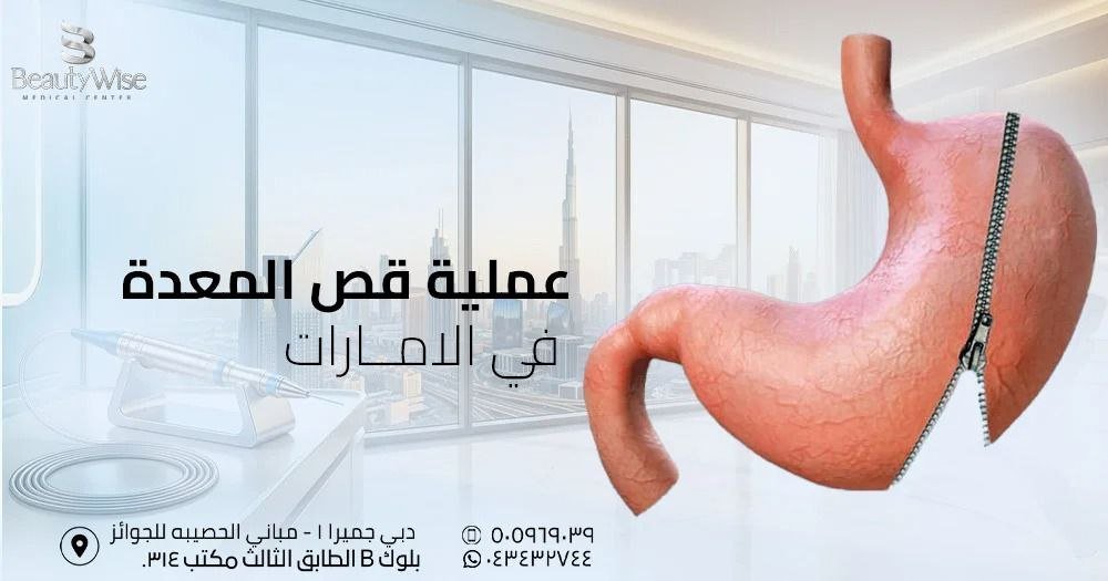 عملية قص المعدة في الامارات