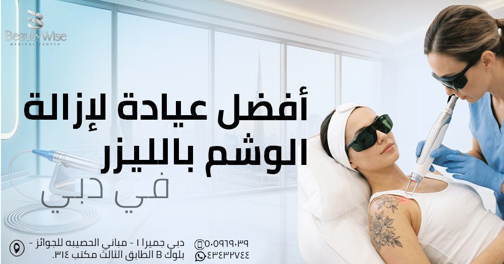 أفضل عيادة لإزالة الوشم بالليزر