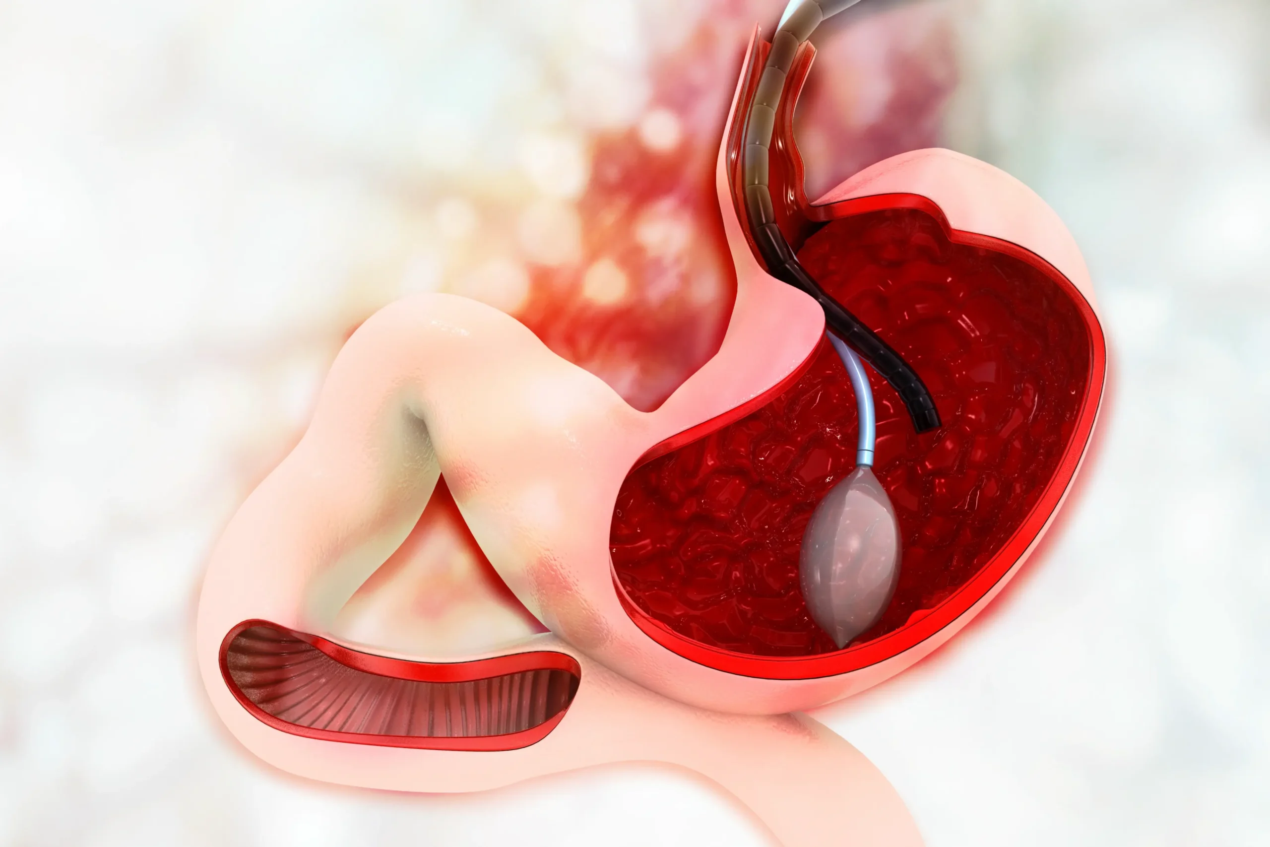 أفضل مركز بالون المعدة في دبي