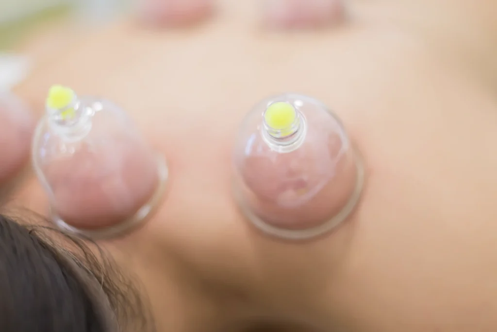 أفضل مركز حجامة في دبي