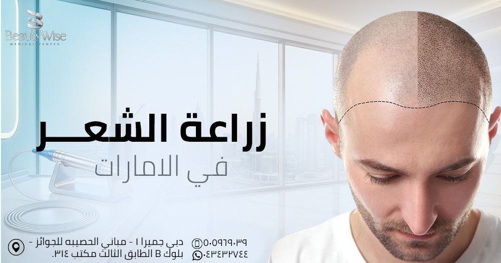 زراعة الشعر في الامارات