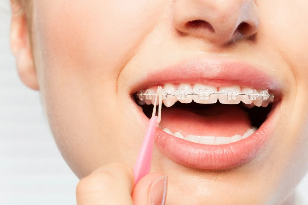 عيادة تقويم أسنان في جميرا