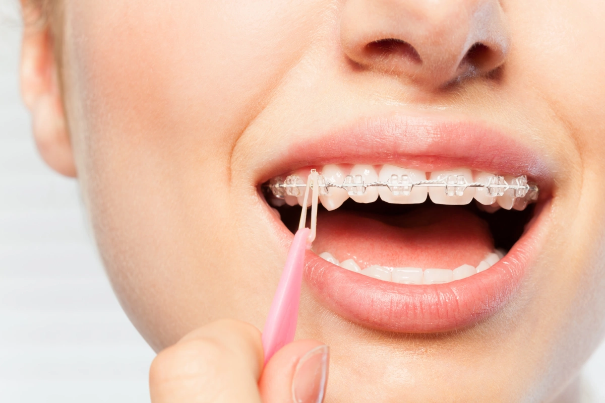 عيادة تقويم أسنان في جميرا