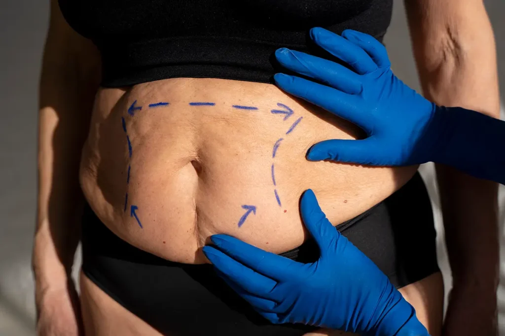 مركز إزالة بالون المنظار في الامارات