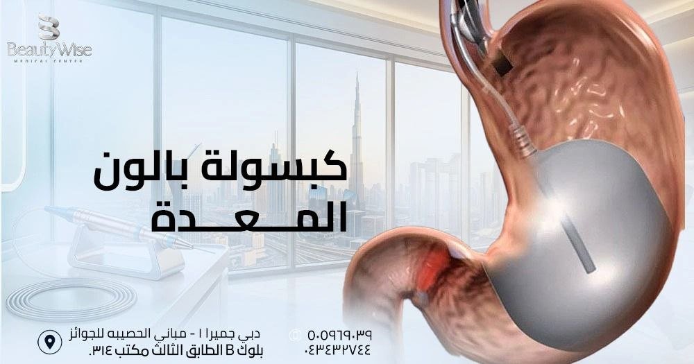 كبسولة بالون المعدة في الامارات