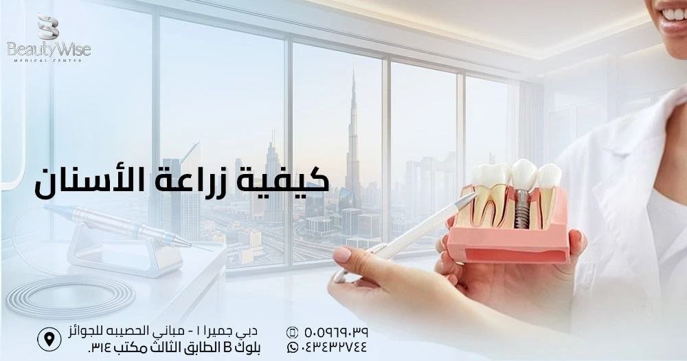 كيفية زراعة الأسنان