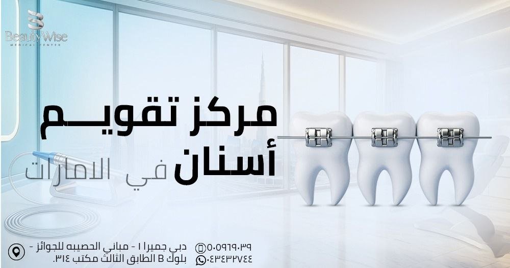 مركز تقويم أسنان في الامارات