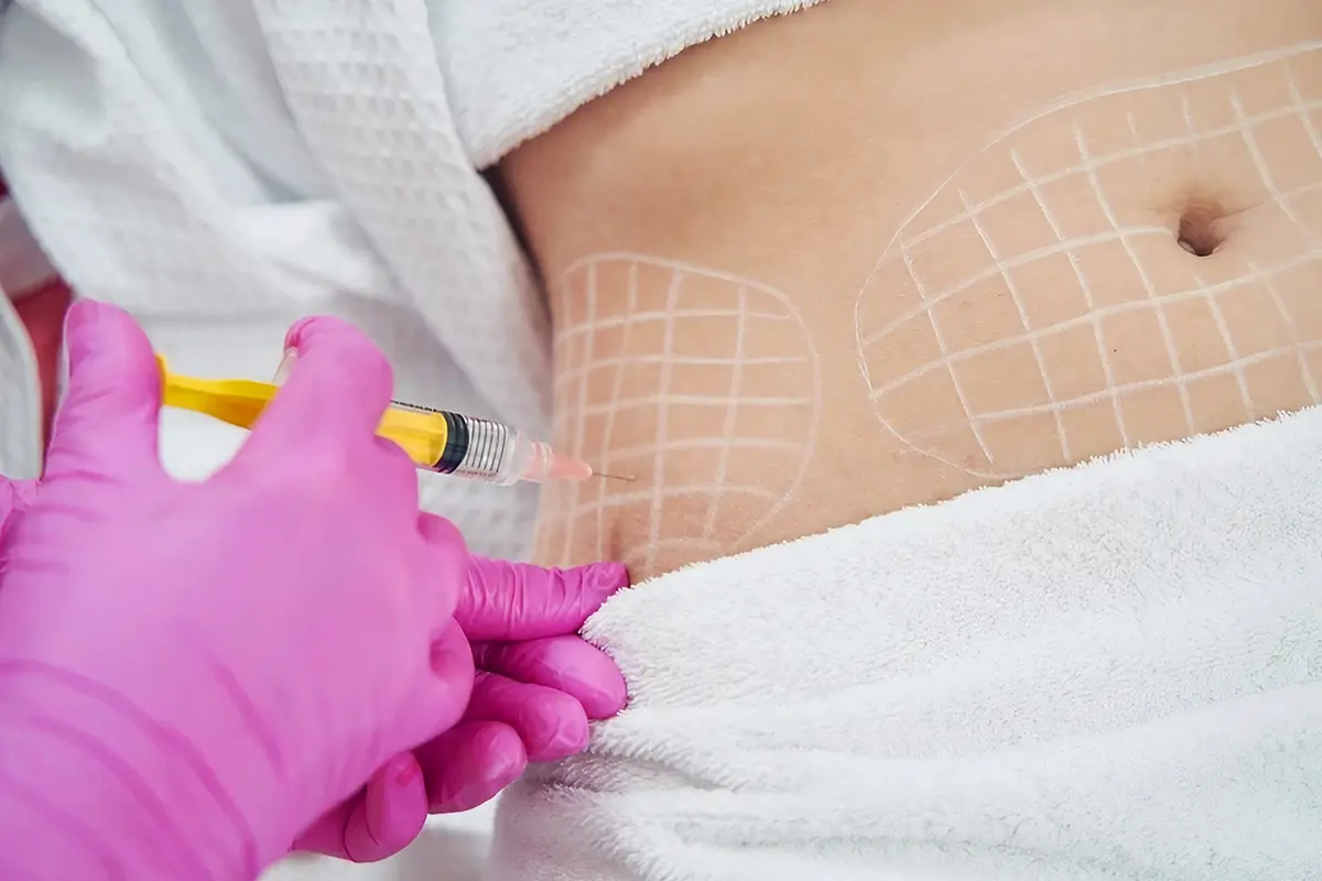 أنواع إبر تذويب الدهون