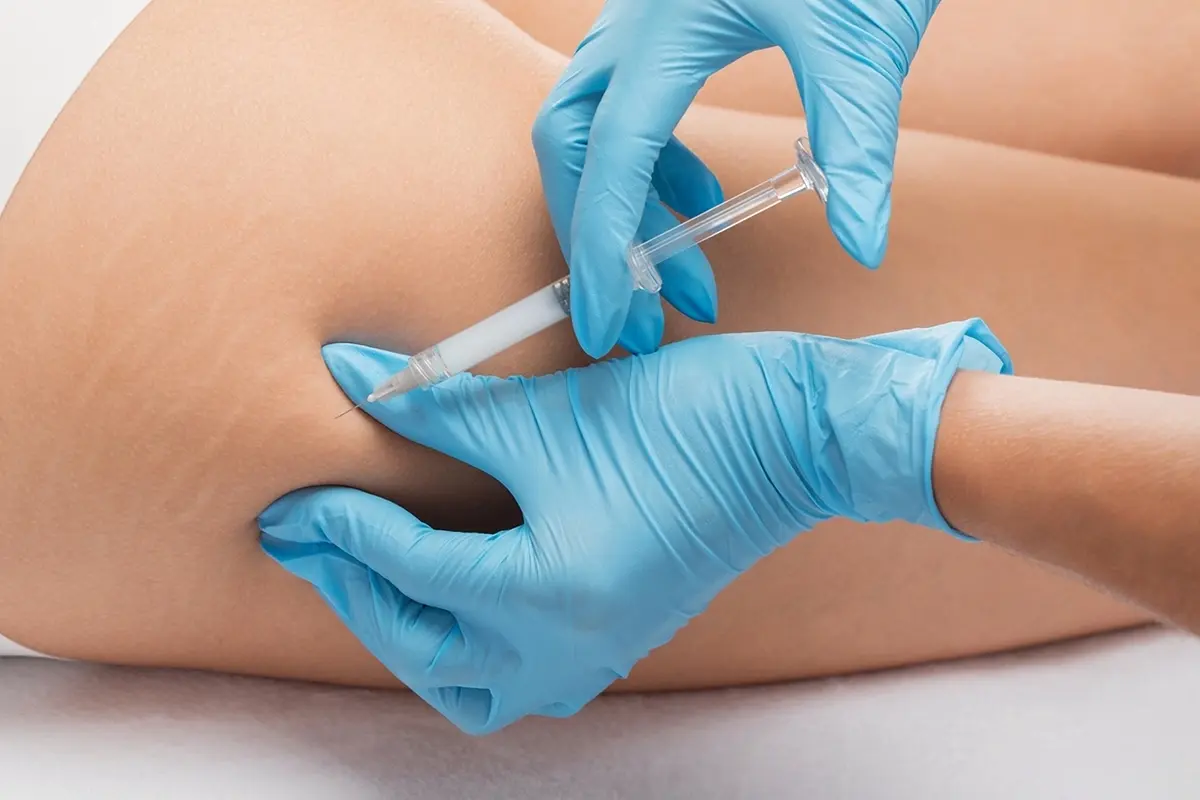 إبر تذويب دهون الأرداف في الامارات