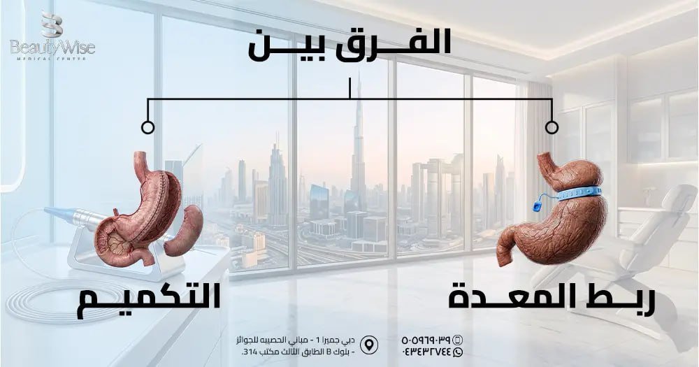 الفرق بين ربط المعدة والتكميمم