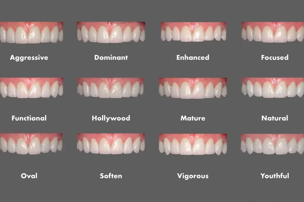 انواع ابتسامات هوليود الأكثر شيوعا في الامارات